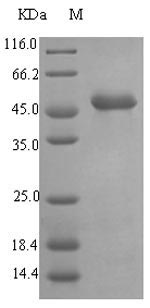 Recombinant Pseudomonas aeruginosa Elastase (lasB) - 20 µg